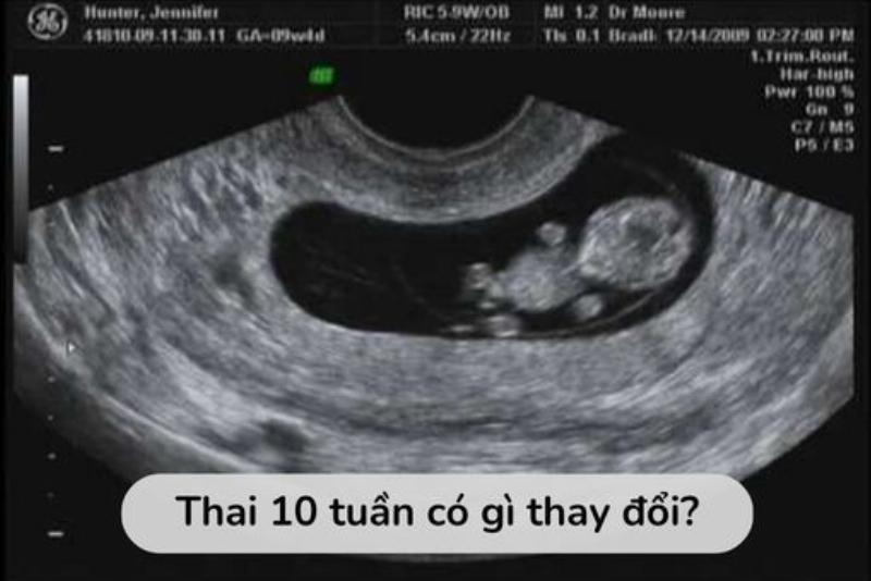 Dinh dưỡng cho mẹ bầu 20 tuần, thực đơn và lời khuyên chuẩn Nhật