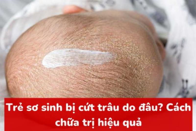 Rửa nhẹ nhàng vùng thóp trẻ sơ sinh