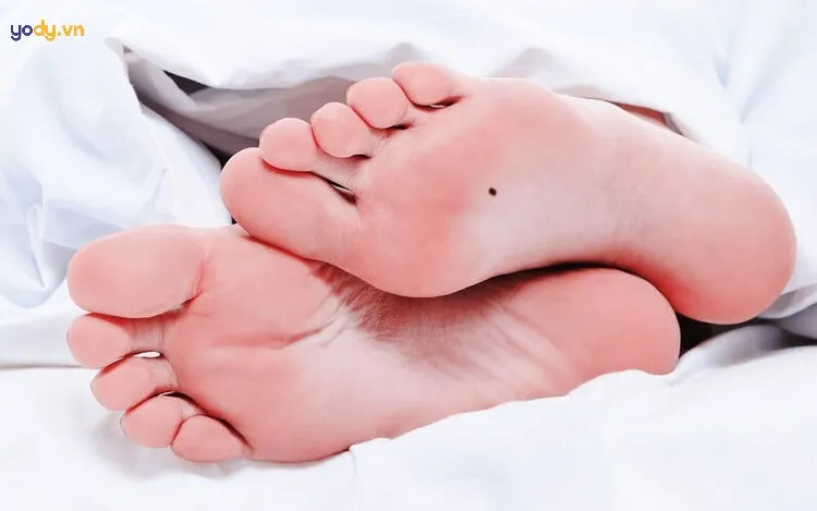 Nốt ruồi ở bàn chân phải phụ nữ nói lên điều gì