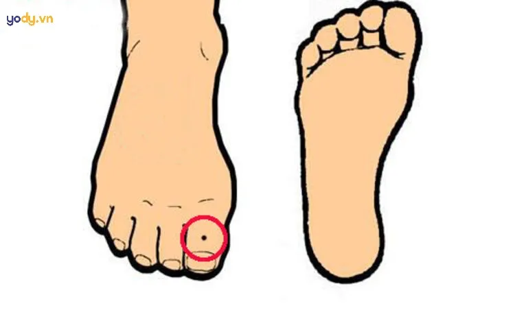 Ý nghĩa nốt ruồi ở ngón chân cái